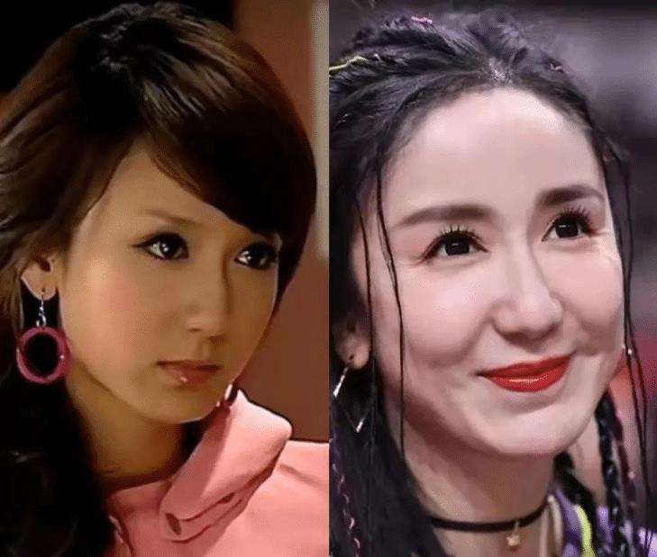 最失败硅胶脸的女星,硅胶脸女明星排行