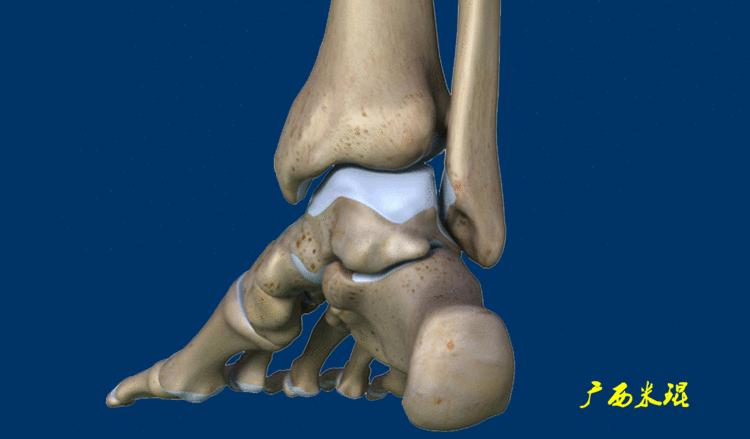 距骨软骨损伤最好的治疗方法,距骨软骨损伤的诊断