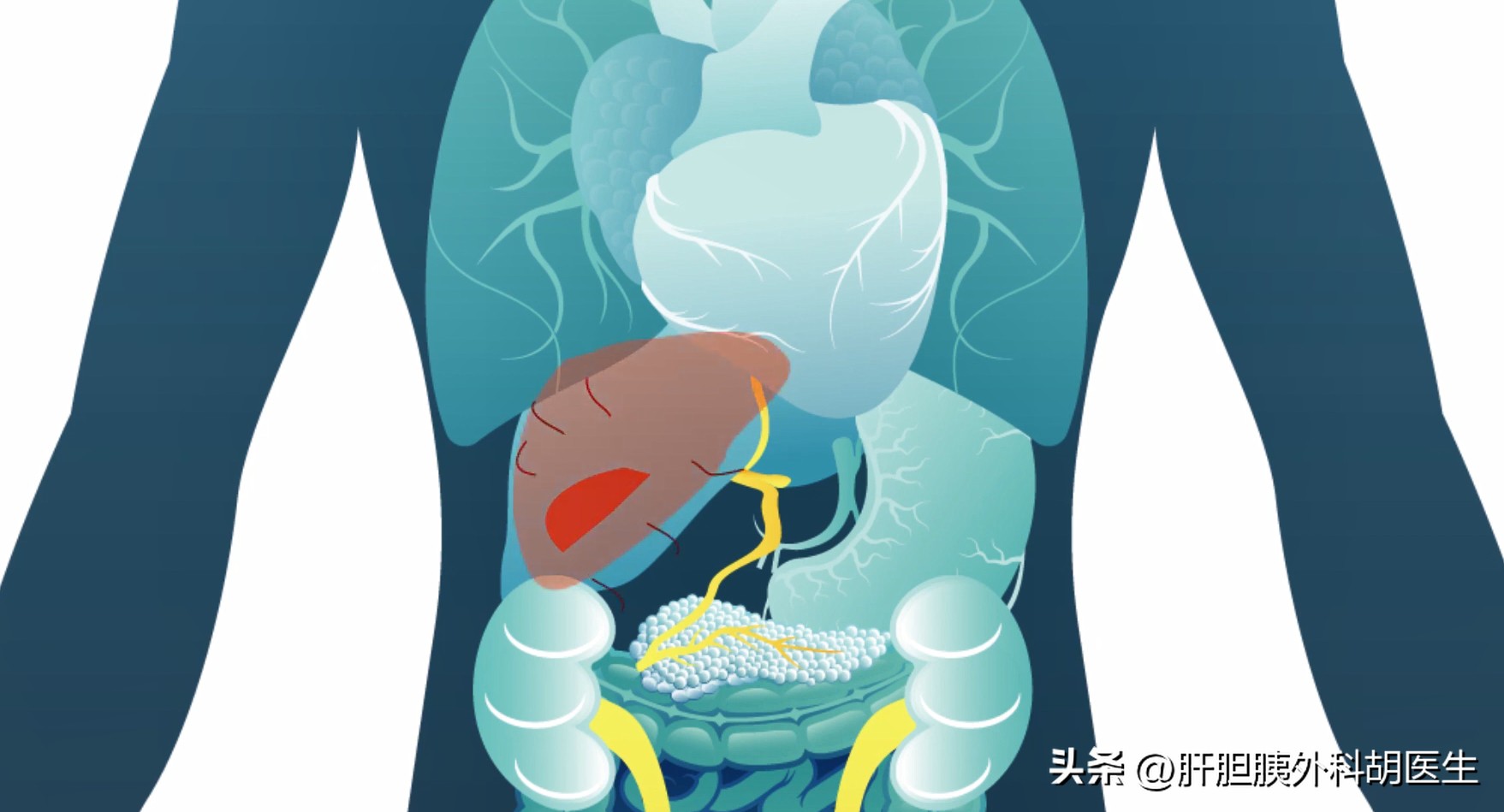 癌症晚期临终关怀,癌症晚期临终关怀有哪些