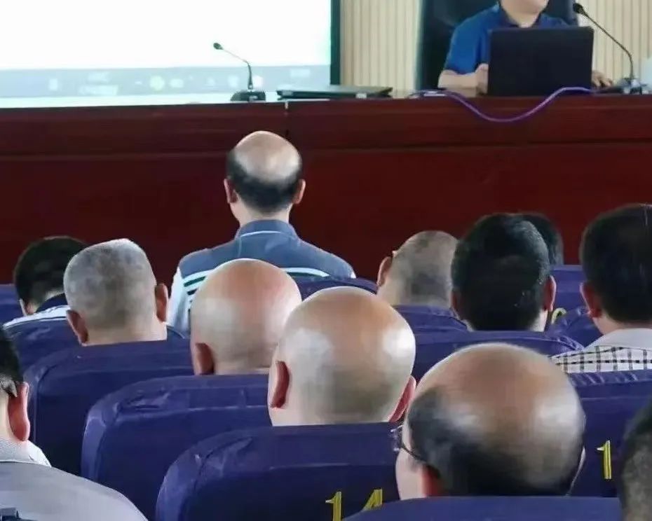 华西招募脱发临床志愿者,华西医院脱发志愿者