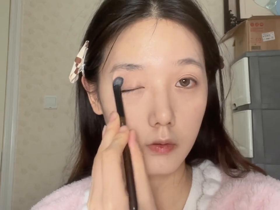 一只眼睛近视50度到75度之间咋办,一只眼睛正常一只眼睛近视275度