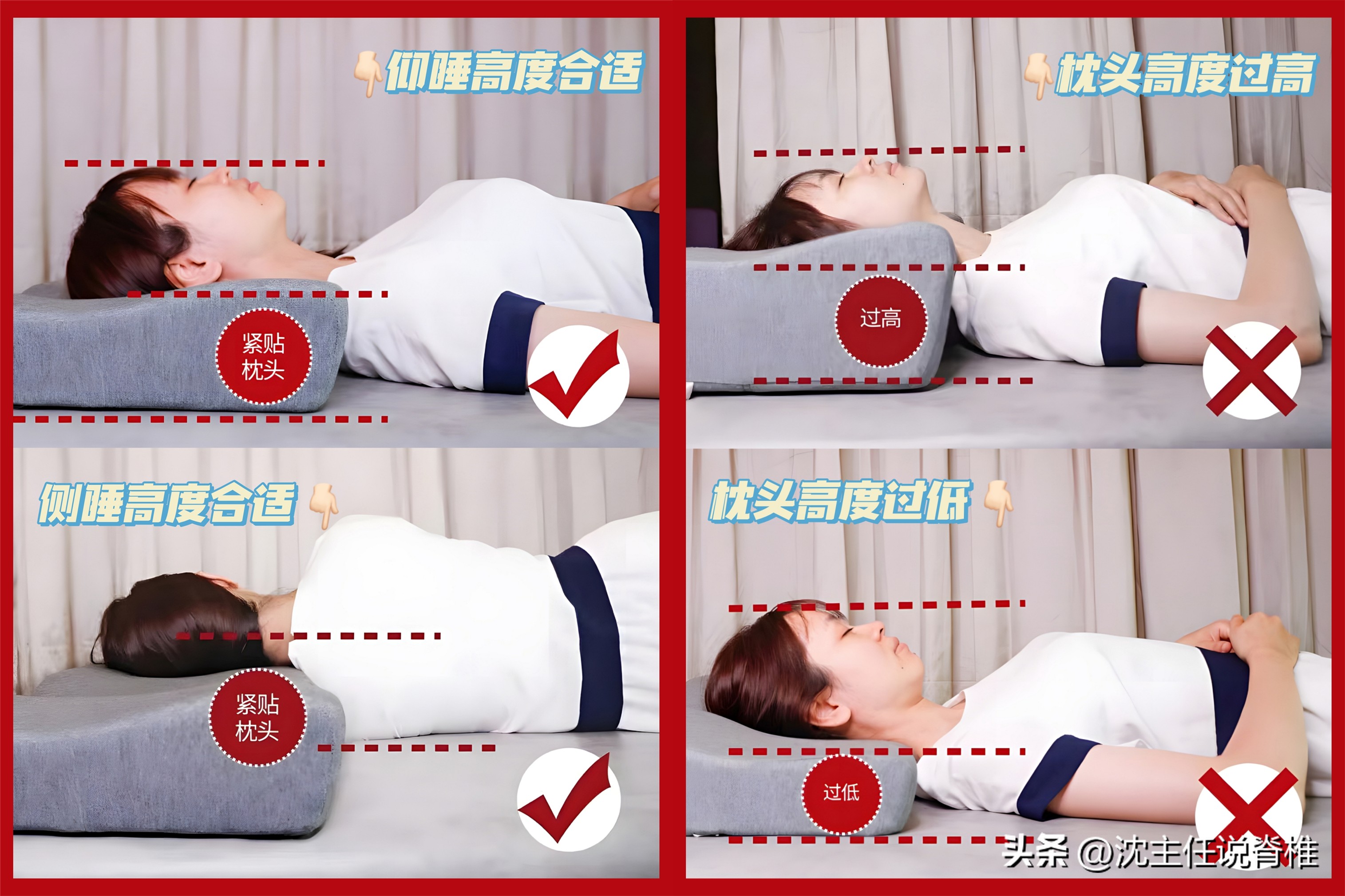 体检颈椎由直变弯,体检结果颈椎有些增生