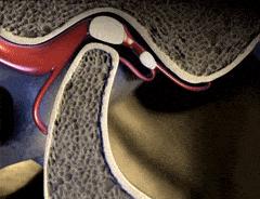 鍦板寘澶╅涓嬮鍏宠妭绱婁贡寮犲彛鍙楅檺,棰炰笅棰屽叧鑺傜磰涔卞紶鍙ｅ彈闄愮殑鐞嗙枟