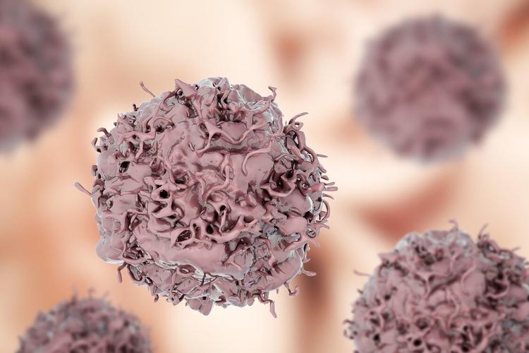 【科普】子宫内膜癌有两种类型，你了解吗？腹腔镜手术效果如何？