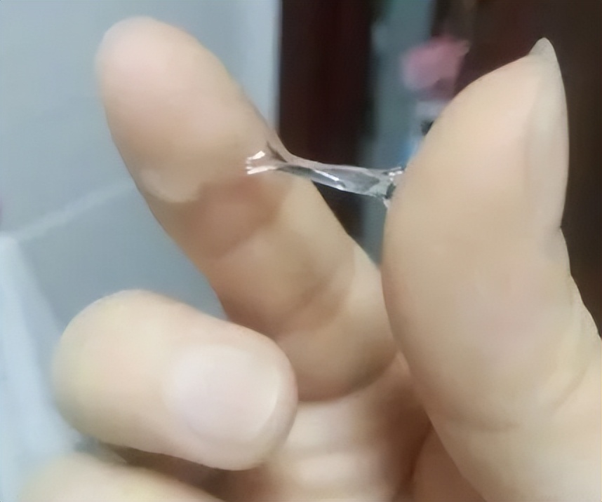 女性阴道有白色泡沫排出来，是咋回事？暗示了什么？医生给出答案