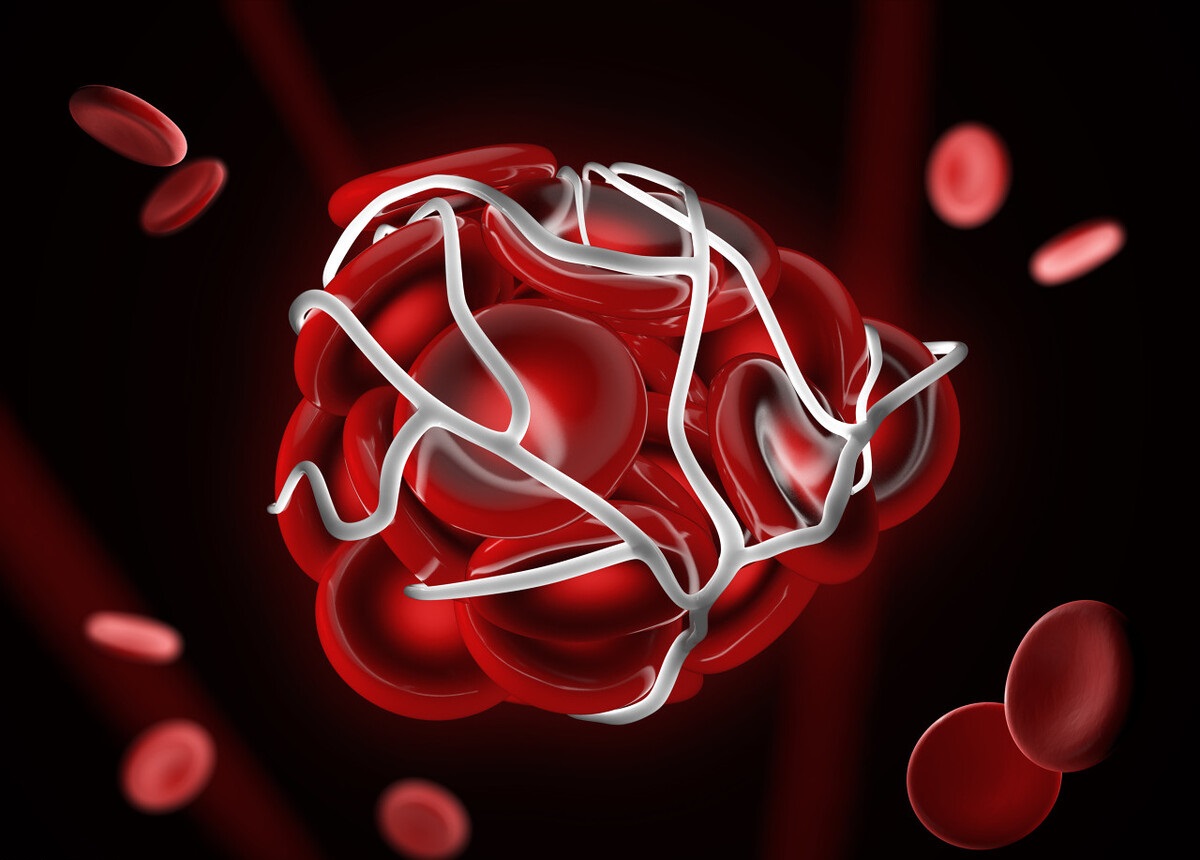 老年人每天服用一片5mg叶酸行吗,老年人补充叶酸和b12应注意什么