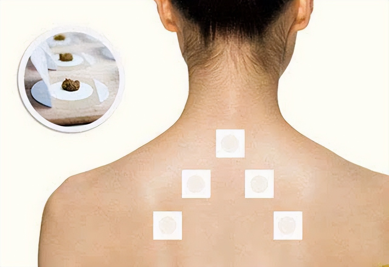 三伏贴不是伏天好不好贴,贴三伏贴是骗局吗