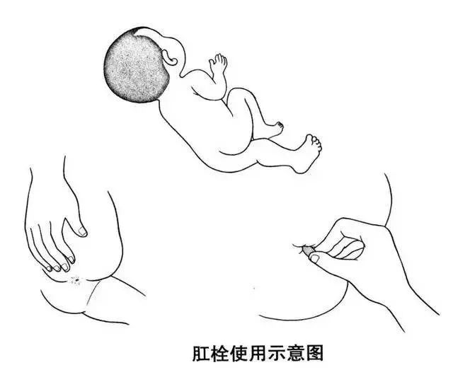 孩子发烧喝退烧药好还是退热栓好,孩子发烧用退热栓好还是退烧药好