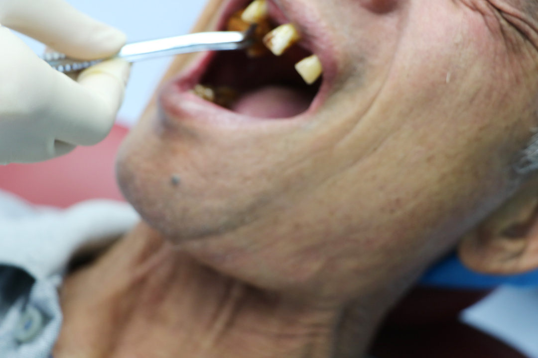 牙医遇到有口臭的病人怎么办,牙医推荐去黄去口臭的牙膏