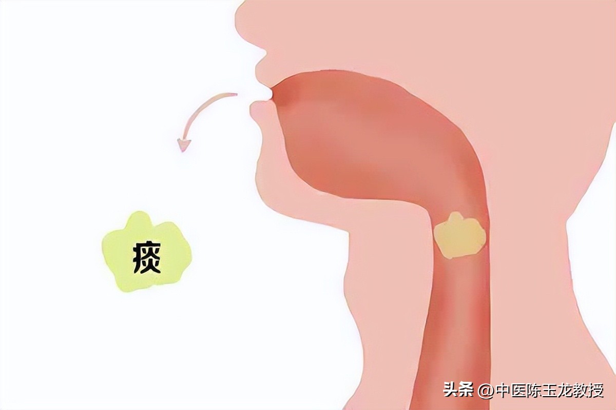 滤泡性咽喉炎中药方子,咽喉炎扁桃体炎常用中药