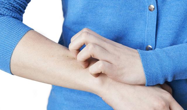 冬天皮肤干燥皮屑满天飞吃什么药,秋衣秋裤皮屑满天飞