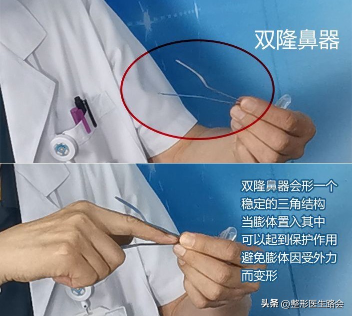 假体隆鼻7天发现歪了可以调整吗,假体隆鼻20年后变化