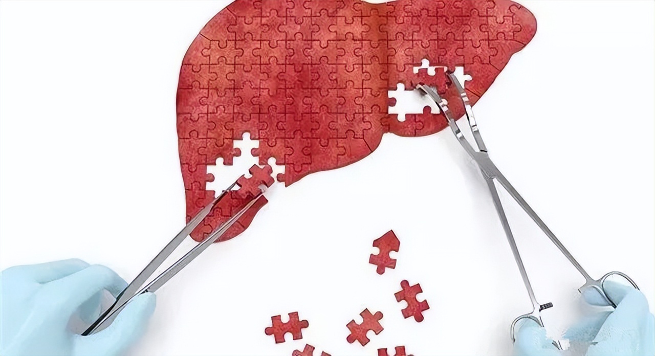 干细胞治疗肝硬化费用,用干细胞治疗肝硬化最好的医院