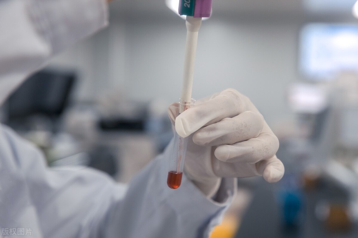 核酸检测阳性igm抗体阴性是误诊吗,核酸阴性血清igm阳性是什么意思