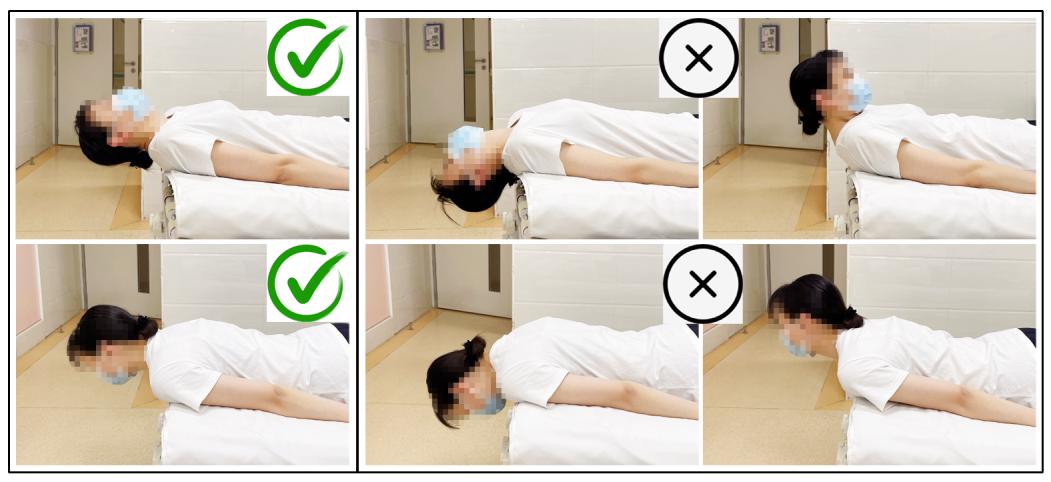 颈痛的最佳治疗方法,最近肩颈疼是什么病毒