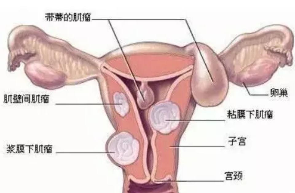 没有子宫的女人，和正常女性有什么不同？2个变化，可能无法改变