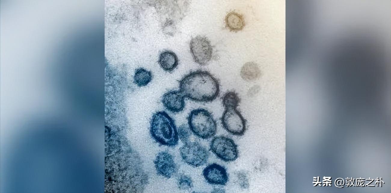 地球上最致命的四种病毒,地球史上最可怕的十种病毒