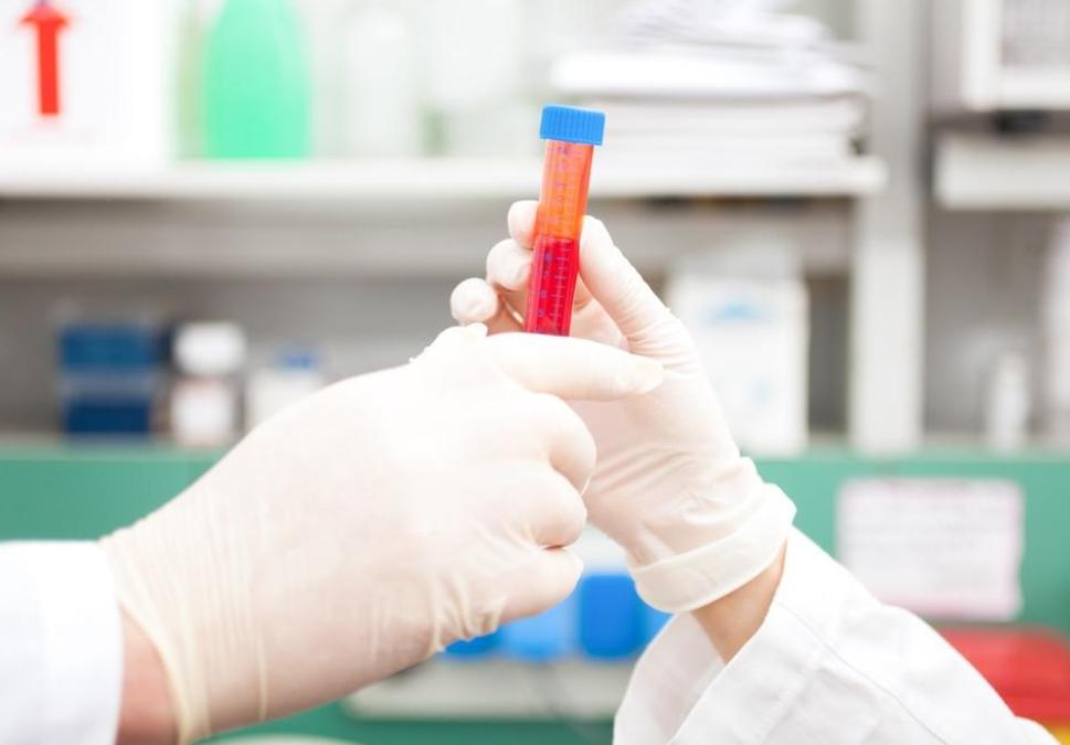 怎么在*生活性**前，判断对象有没有性病？2个方法，男女都该知道