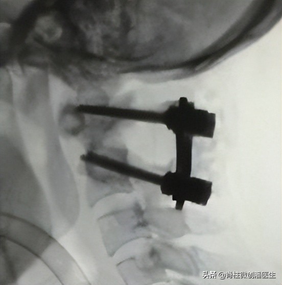 宝宝脖子右歪应该往哪看,百天宝宝脖子光往一边歪