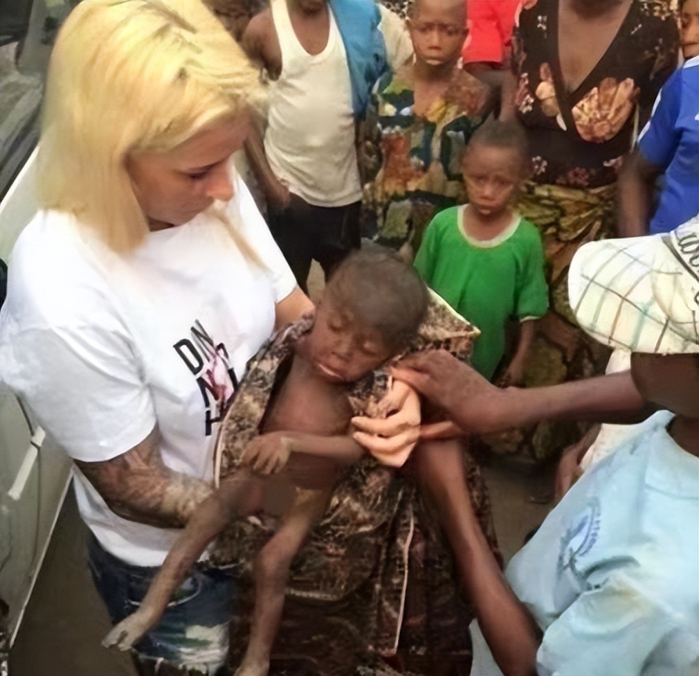 2013年，非洲2岁“巫童”遭父母遗弃，饿得皮包骨，如今还活着吗