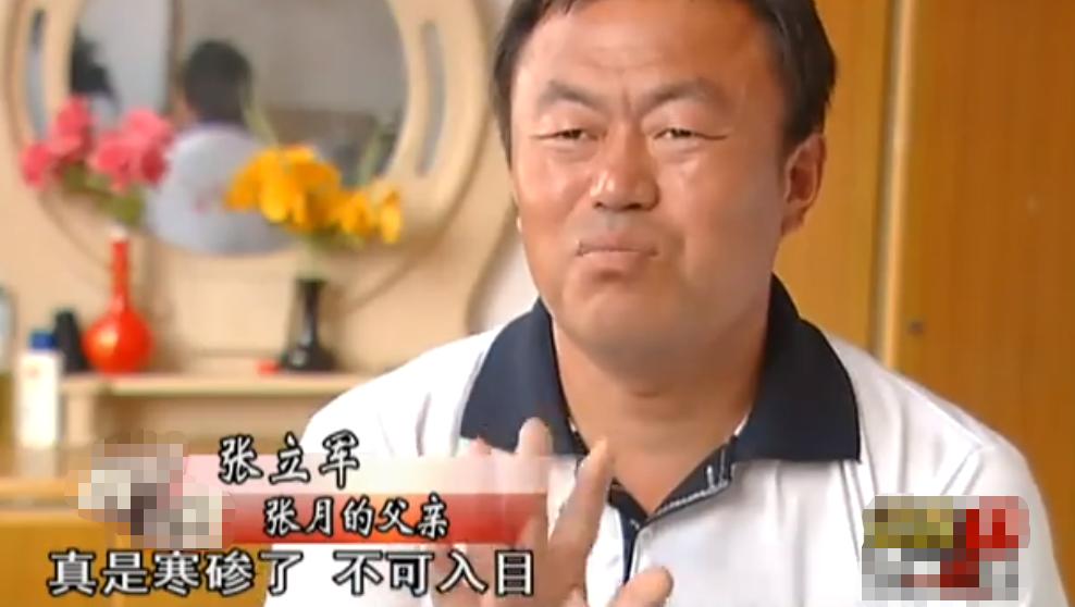 20岁小伙被重度烧伤七年后续,山东男子下肢被烧伤