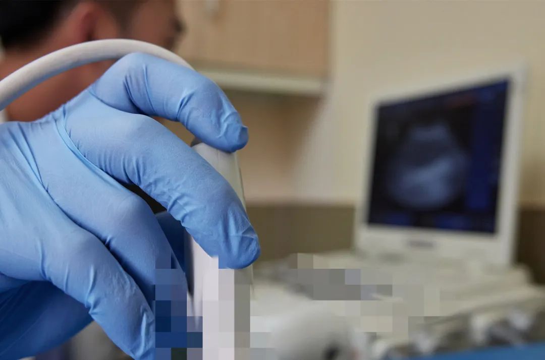 前列腺彩超知多少