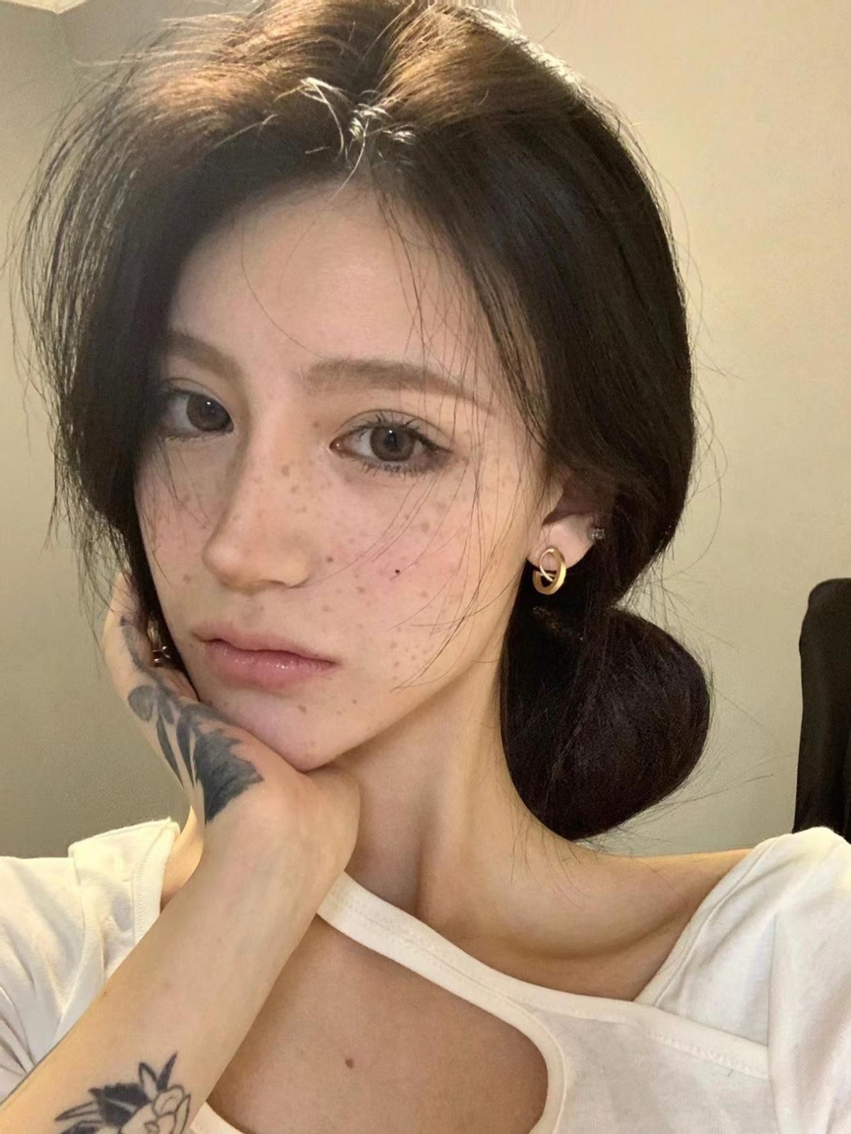 年轻长老年斑的原因以及解决方案,年纪轻轻就开始长老年斑怎么办