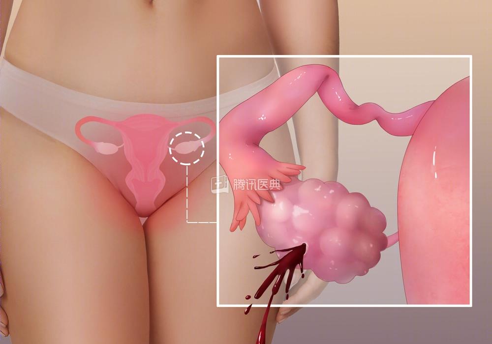 19岁女大学生离世捐器官救5人,20岁女大学生捐卵