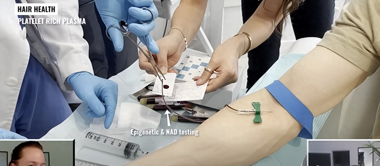 45岁亿万富翁与儿子换血,45岁亿万富豪重回18岁