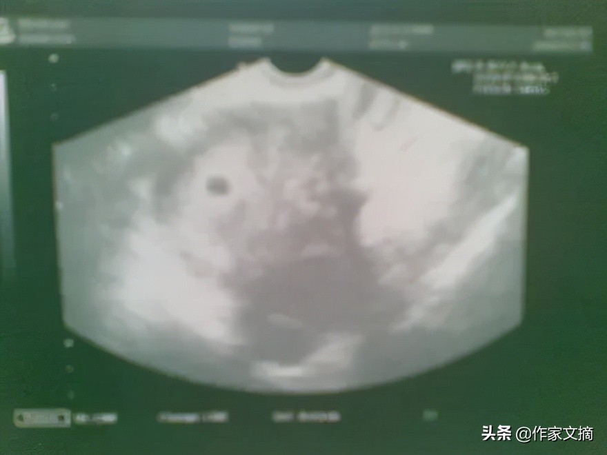 纳入医保试管婴儿费用,试管婴儿纳入医保的地区2024年