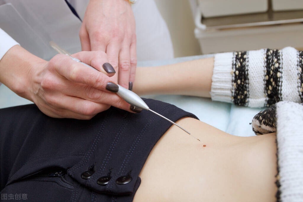 皮肤长小疙瘩小肉球怎么弄,皮肤上长了小肉球要怎么才能治好