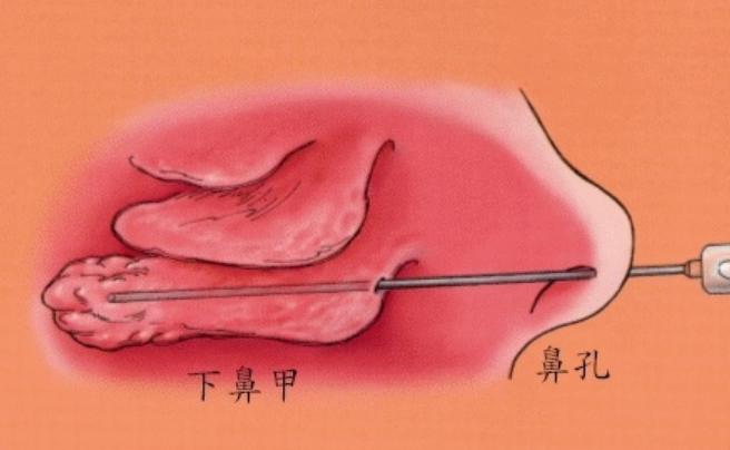 “邋遢鬼，吃鼻屎”，孩子的“怪癖”背后，藏着三个原因