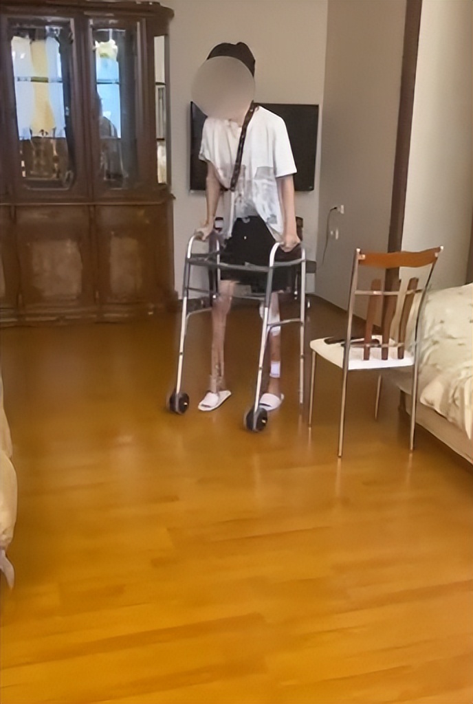 日本1米5小哥砸1600万疯狂整容增高！断骨惨烈过程吓傻网友