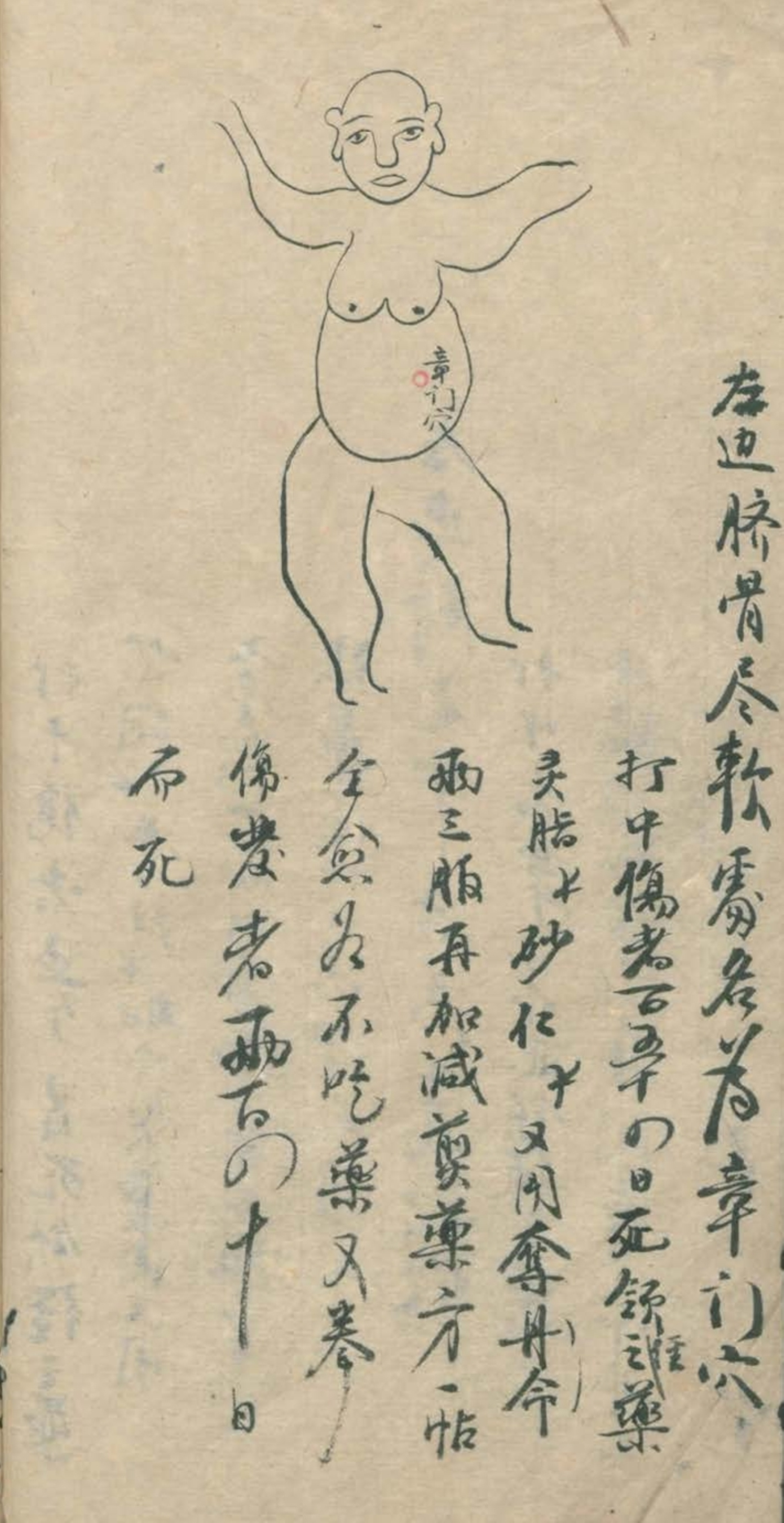 武当秘传跌打八法,民间中医古籍手抄本专医跌打秘方