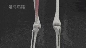 不想成为“唐老鸭”，这些在家就能做的平足练习一定要学起来！