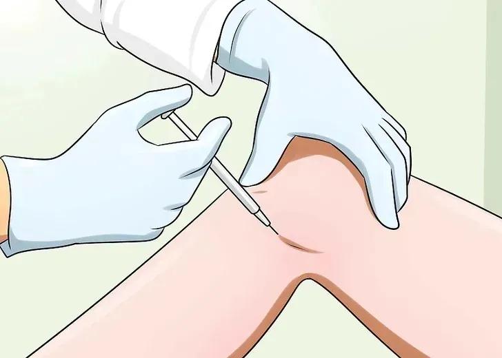 了解：骨性关节炎的康复治疗