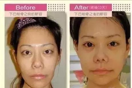 盘点那些整容整的最厉害的人,整容整的最厉害的三位女士