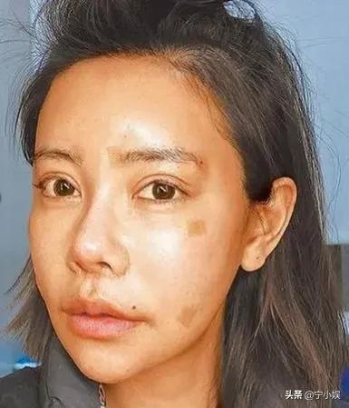 整容达人200次整容失败整成僵尸,整容成功逆袭案例削骨