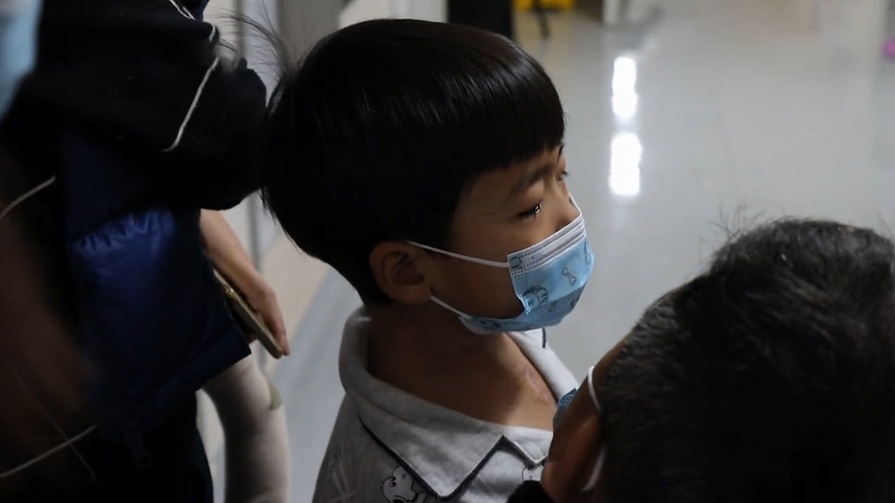 心脏发育畸形,九岁男孩经历四次心脏手术