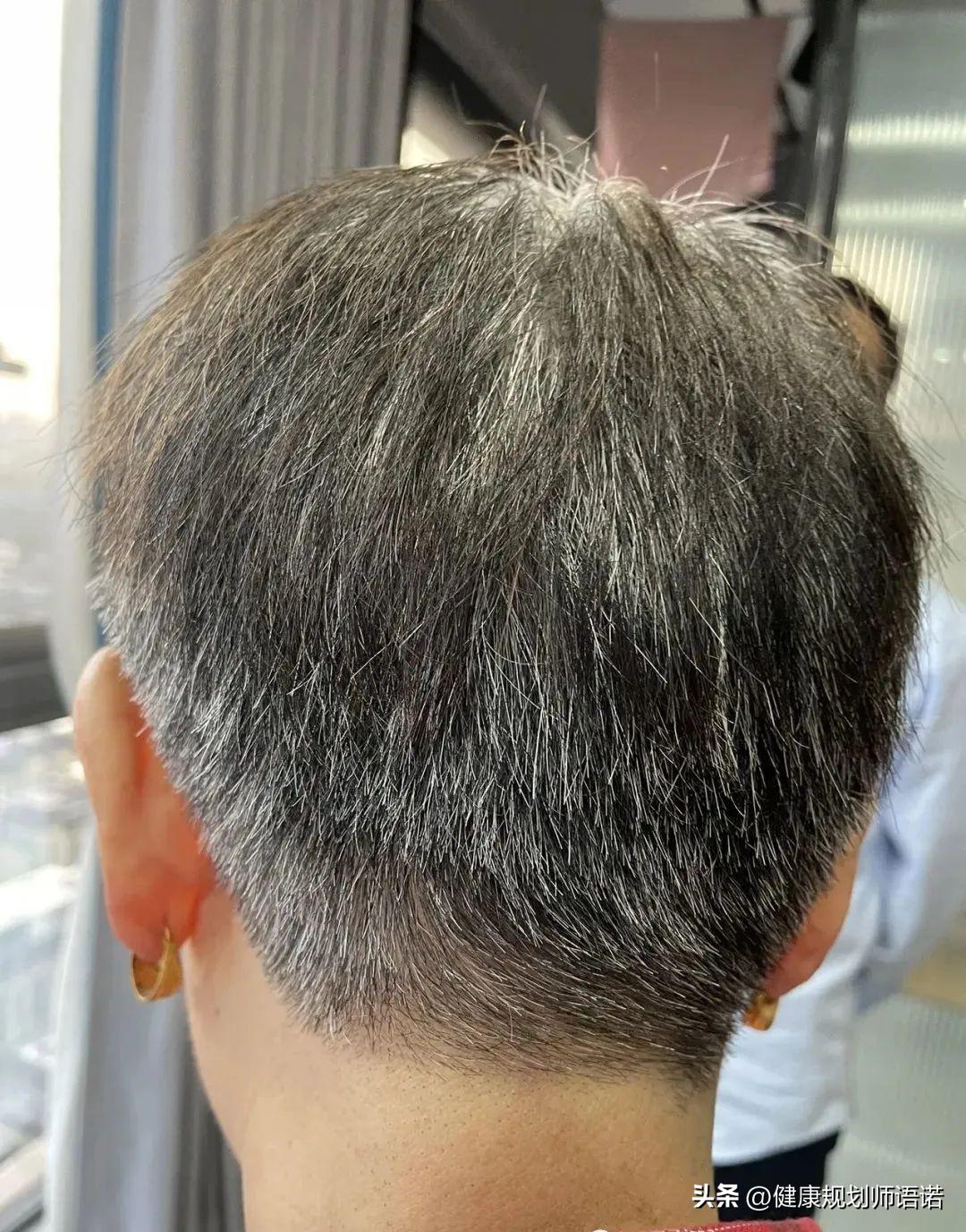 因宫颈问题走进阳光森林，用营养拯救了整个家族的健康