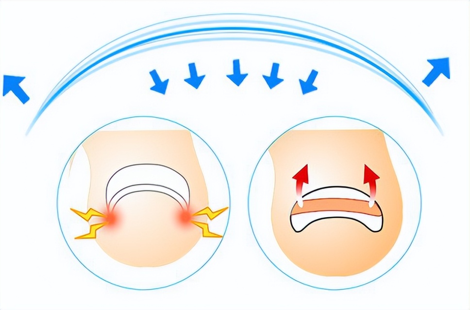 一走路脚趾甲痛,甲沟炎拔完脚趾甲很疼怎么办