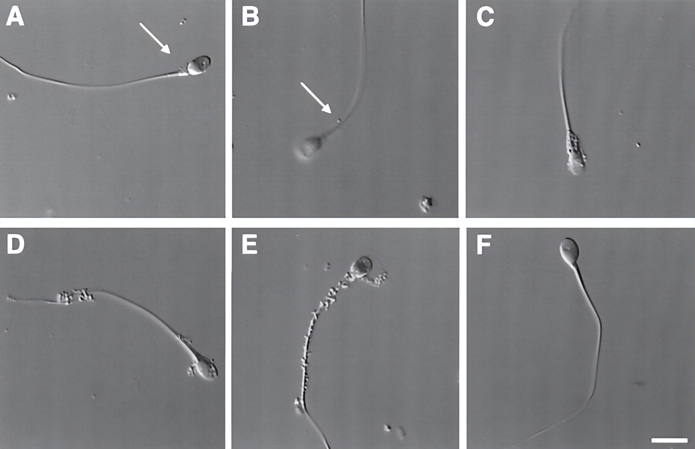 看不育不孕要禁食吗,看不孕不育要看专家吗