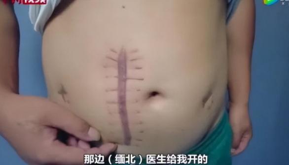 缅北亨利集团现状最新消息,警方揭秘真实的缅北亨利集团视频