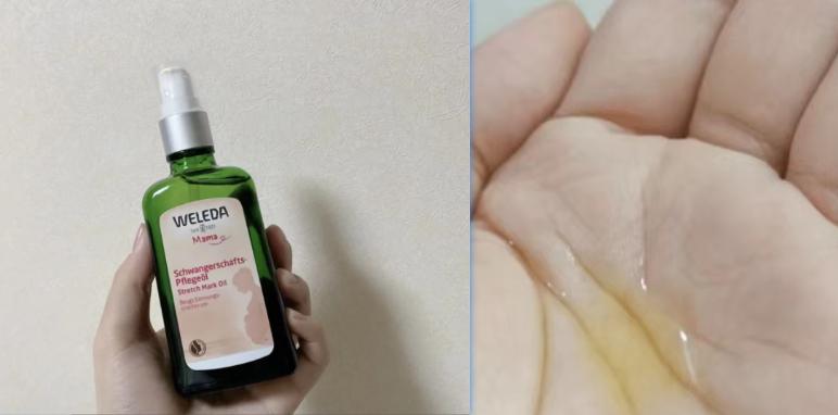 消除妊娠纹是不是智商税,去除肥胖纹妊娠纹产品