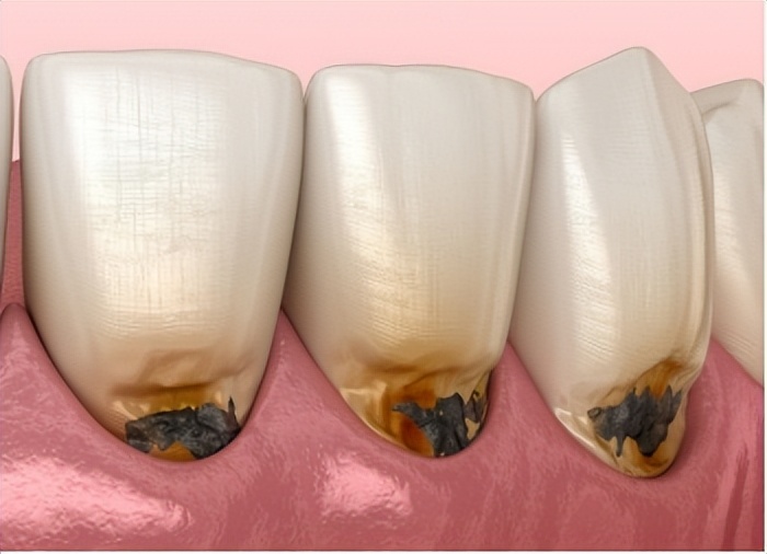 2022飞利浦儿童电动牙刷哪个好用,飞利浦儿童电动牙刷推荐测评