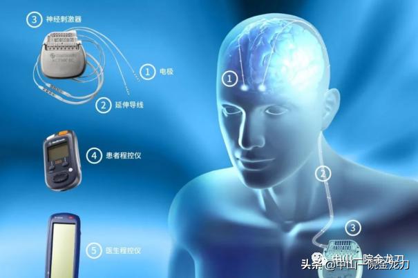 小脑萎缩跟帕金森病一样吗？如何有效地治疗？