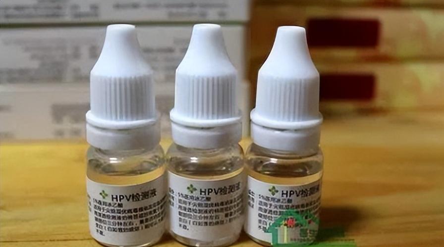 尖锐性湿疣用食用醋可以检测吗,食用白醋能做湿疣醋酸白试验吗