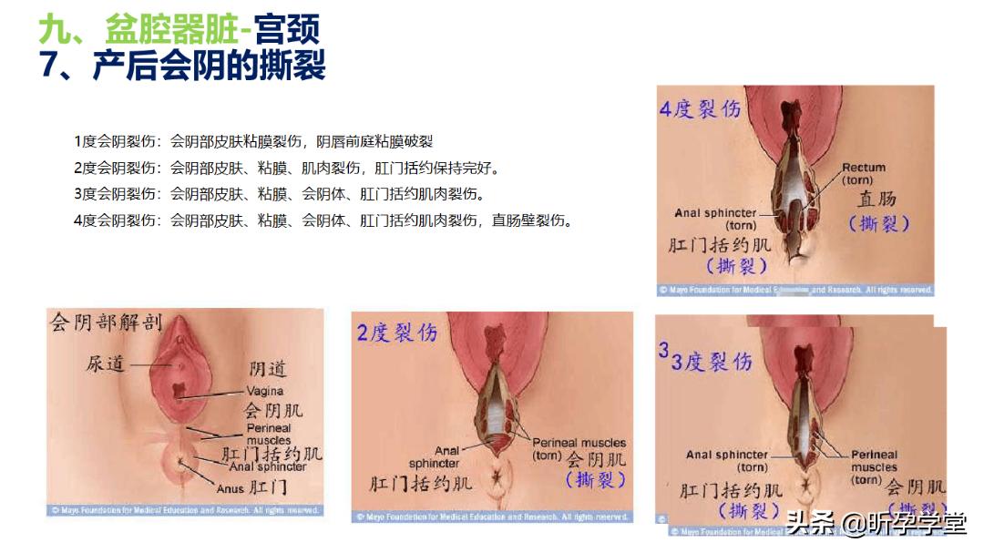 薅羊毛就是现在，再享多重福利|盆底健康管理，线上线下双重学