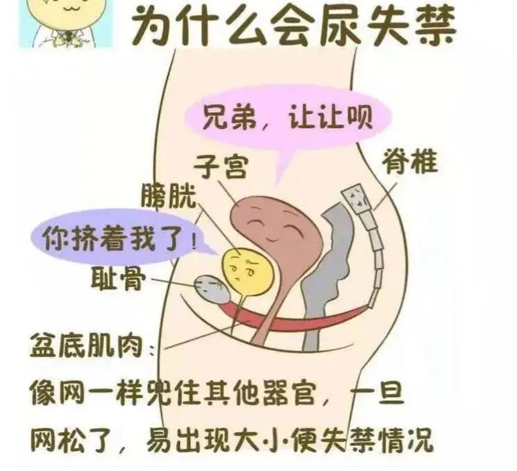 漏尿很尴尬怎么办,漏尿小尴尬的化解方法