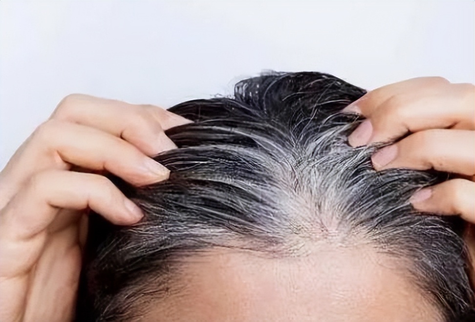 白头发通常是哪个部位开始变白,白头发的不同位置的原因